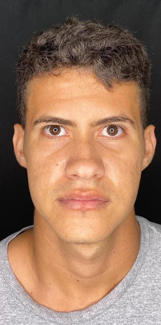 Depois do caso 5